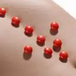 Quels sont les médicaments qui Constipent ?
