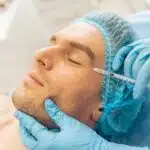 De l’acné aux cicatrices : options esthétiques et chirurgicales